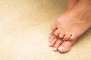 Funghi piedi “PIEDE D’ATLETA” - cosa sono, come riconoscerle, cura